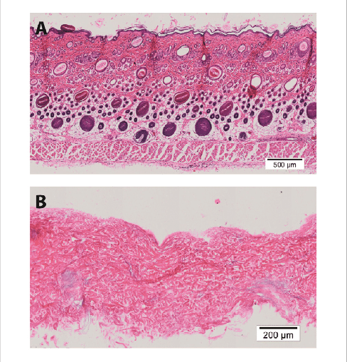 histology of processed rat skin Representative figures of H E of full thickness rat